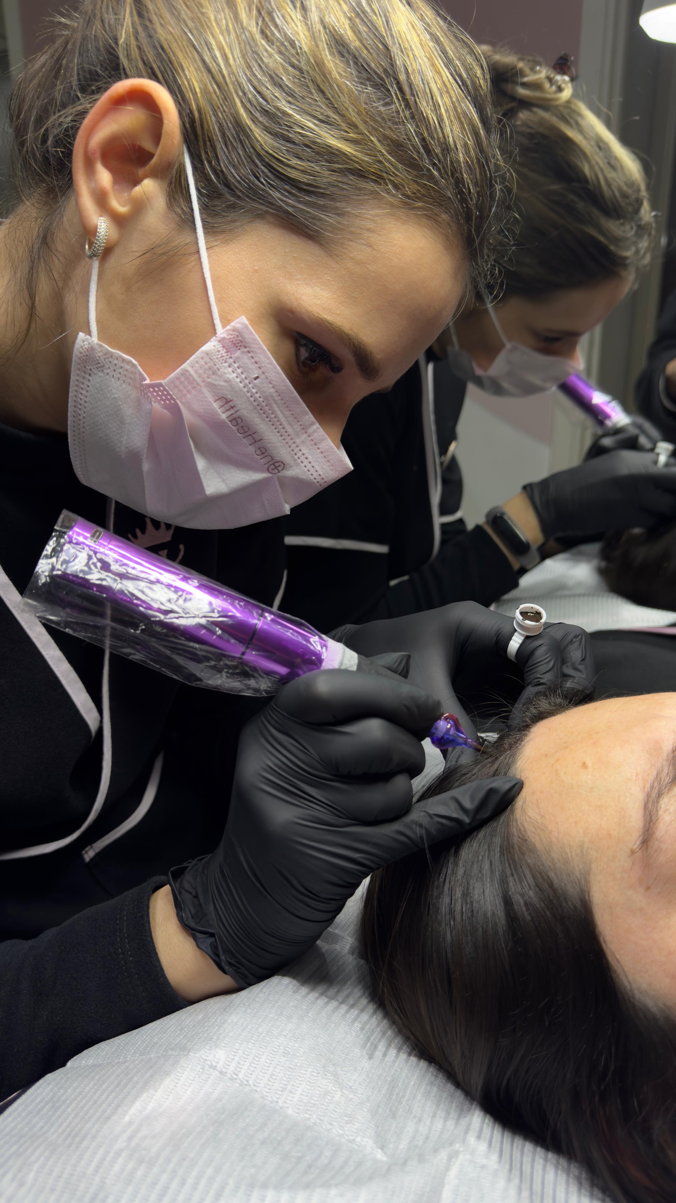 Micropuntura Capilar